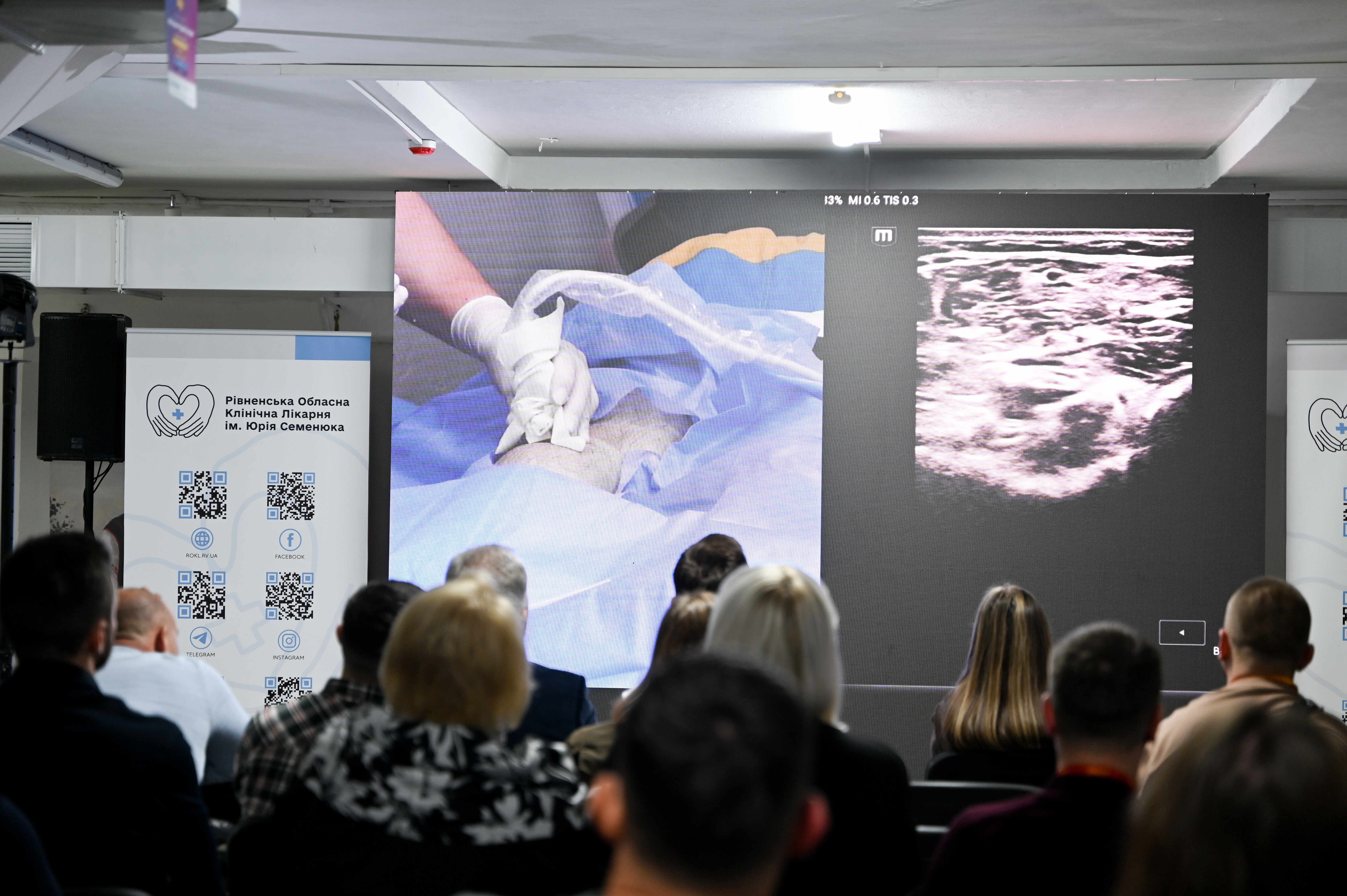 трансляція "наживо" з операційної малоінвазивного втручання