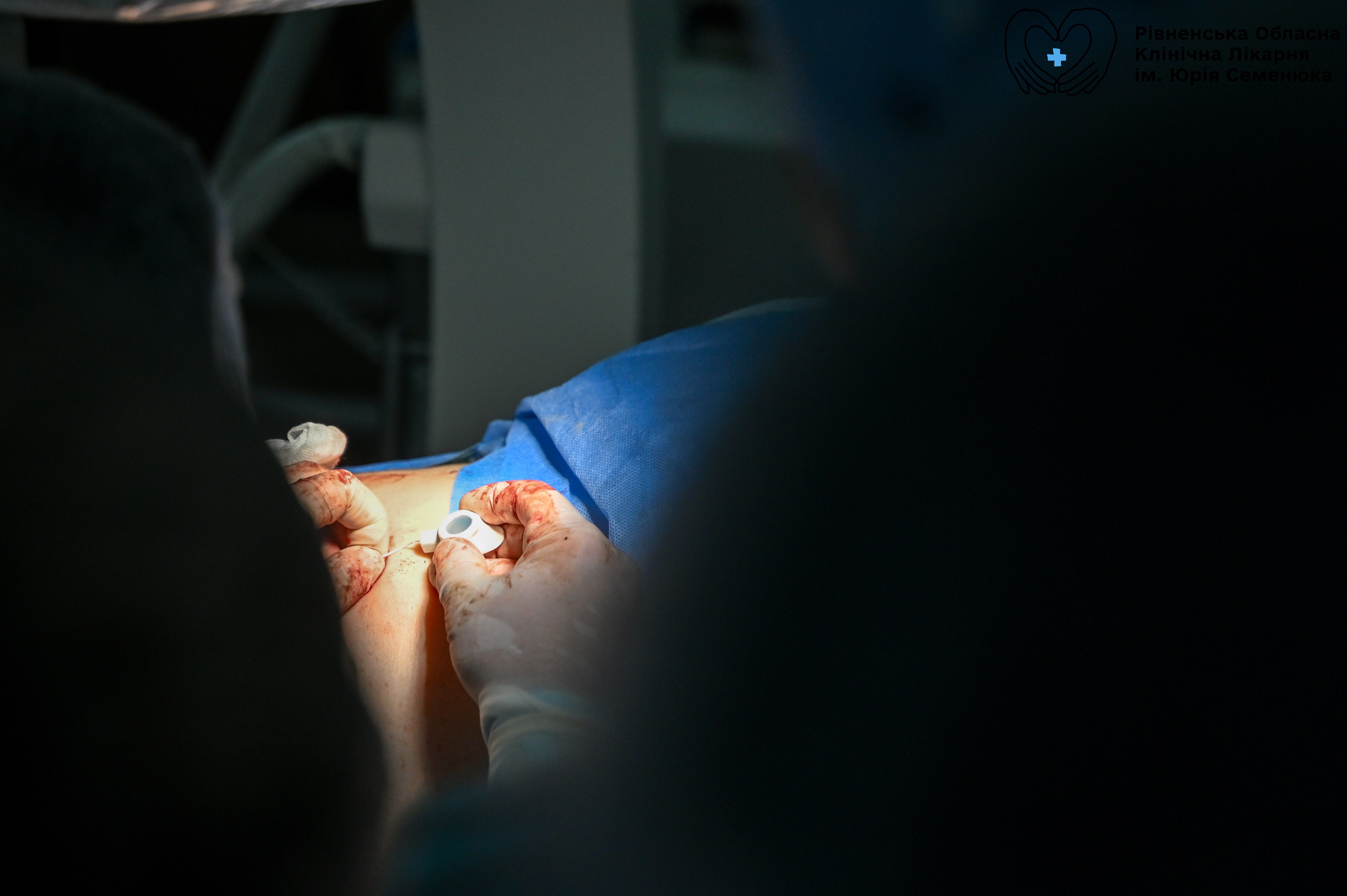 встановлення інтратекальної порт-системи